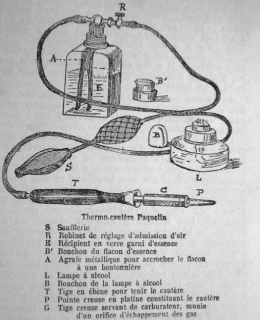 Storia della cauterizzazione, history of cauterization, histoire de la